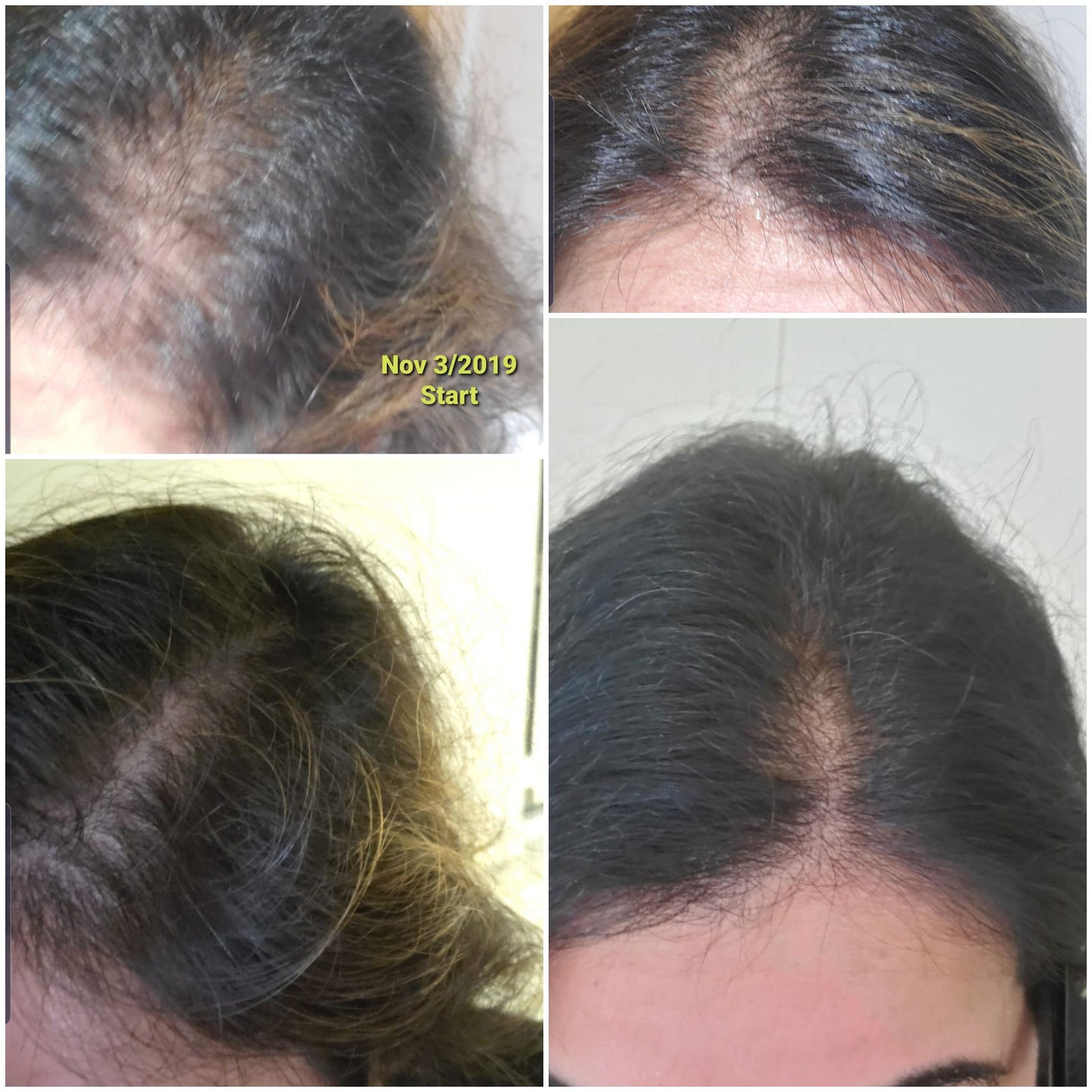 Organic Miracle Hair Growth Oil  4 oz
